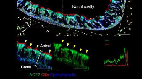 SARS-CoV-2 Replication Targets Nasal Ciliated Cells Early in COVID-19 Infection