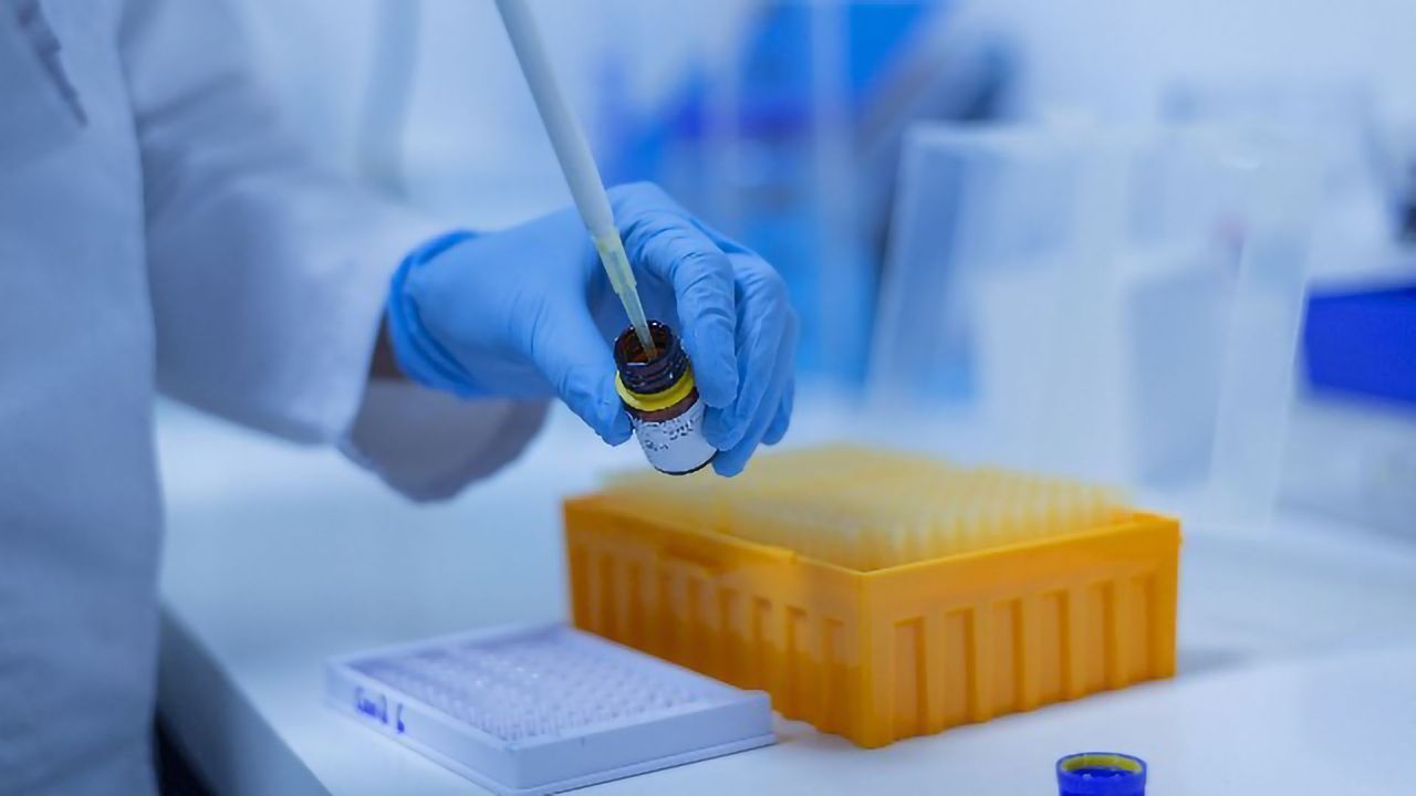 The Need for Efficiencies in the DNA Cleanup Workflow