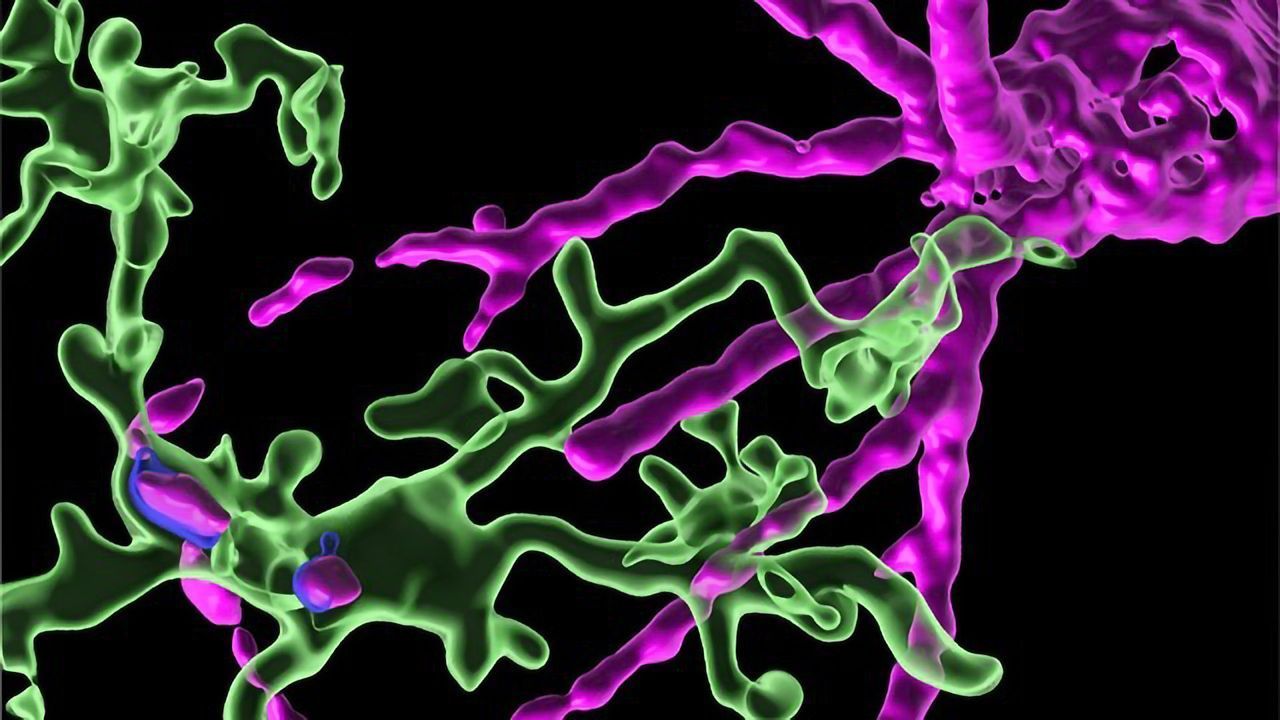 Repeated Ketamine Anesthesia Restarts Plasticity in the Brain
