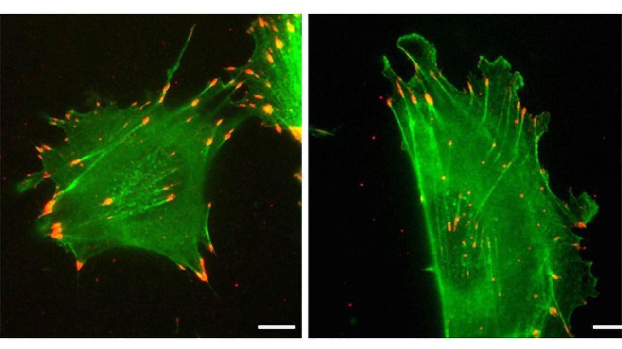 A Tale of Two Proteins and the “Secret Code”