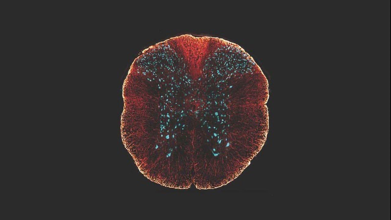 "Zombie Cells" Give Clues to Spinal Cord Injury Repair