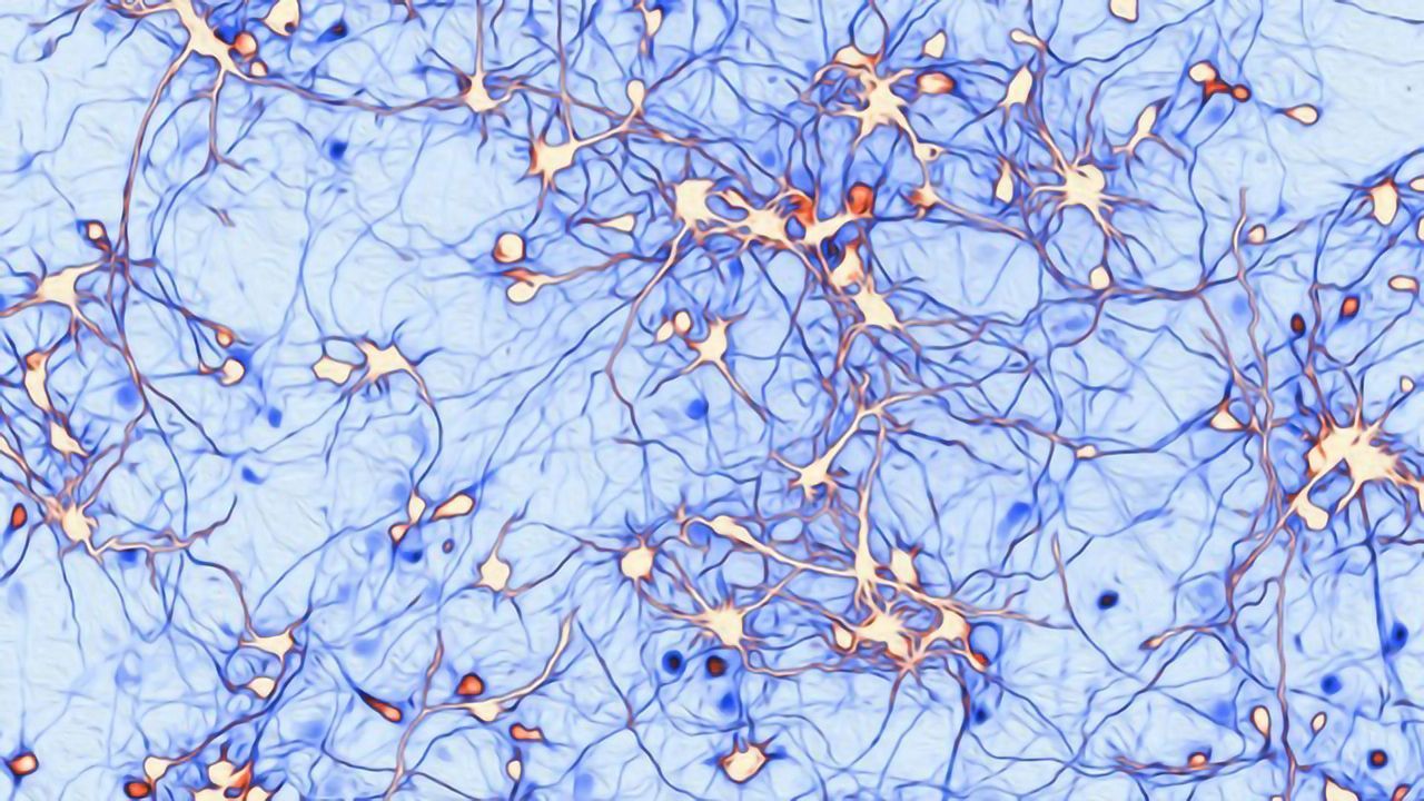 Genetic Mutation Causes Extremely Rare Epilepsy