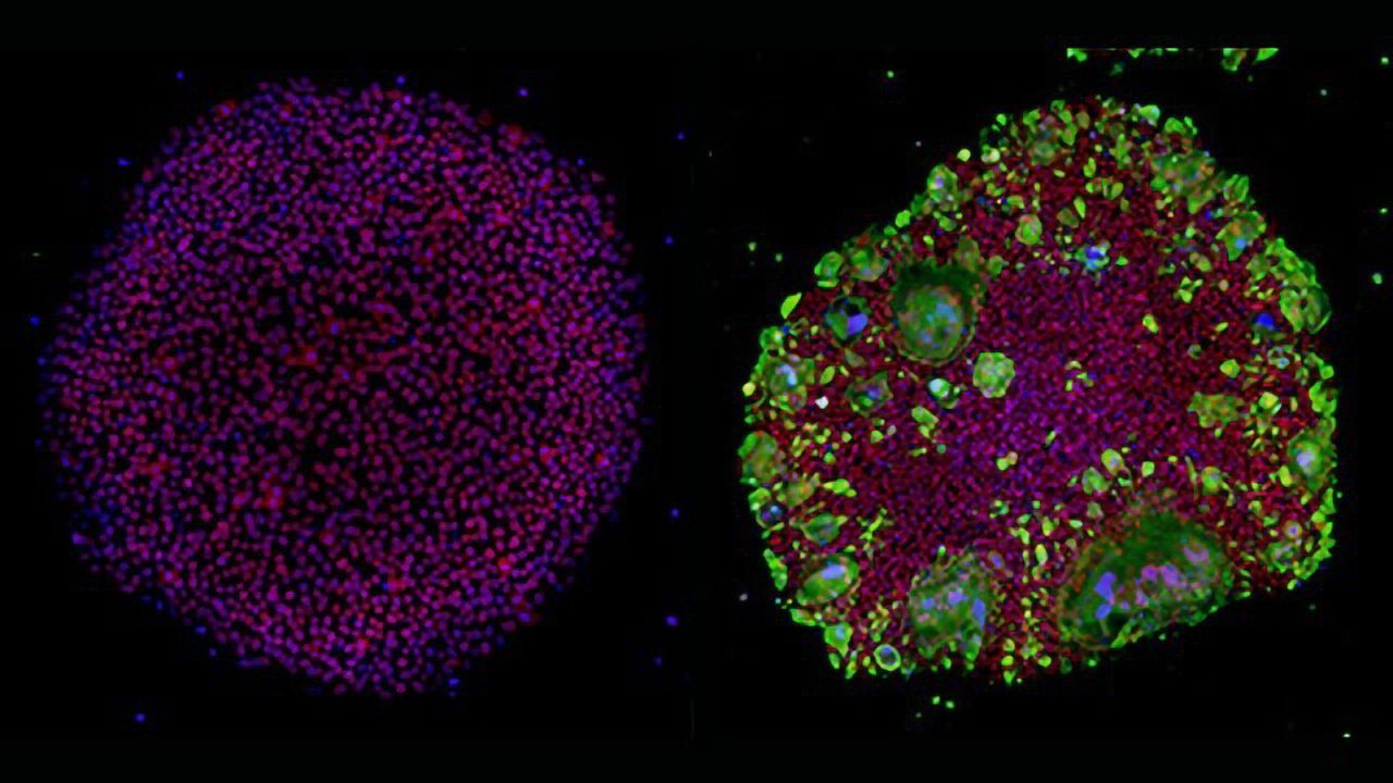 New iPSC Model for COVID-19