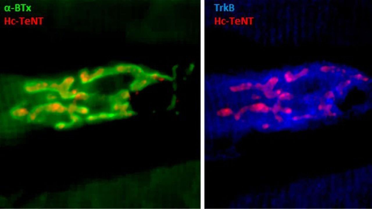 Tetanus Neurotoxin Fragment Proposed for Treatment of Depression