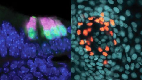 A Common Ancestor for Cells Involved in Hearing and Touch