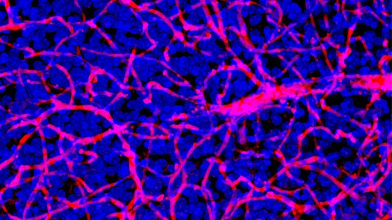 Trojan Horse Helps Get Drugs Past the Blood–Brain Barrier