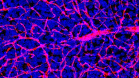 Trojan Horse Helps Get Drugs Past the Blood–Brain Barrier