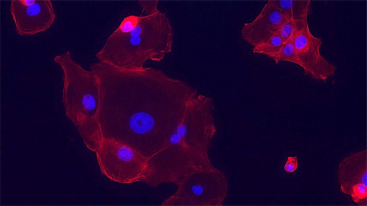 How Drug Resistance Arises in Lung Cancer