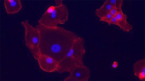 How Drug Resistance Arises in Lung Cancer