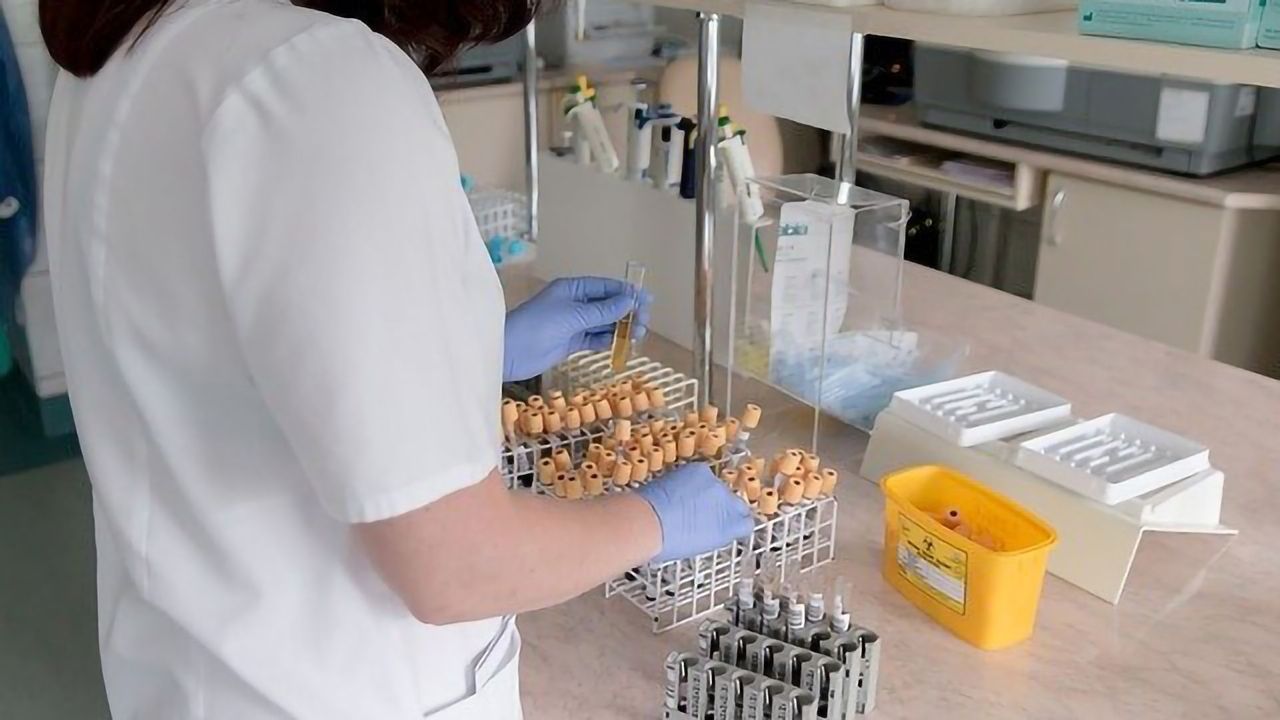 Mass Spectrometry a Key Tool in Understanding Huntington's Disease