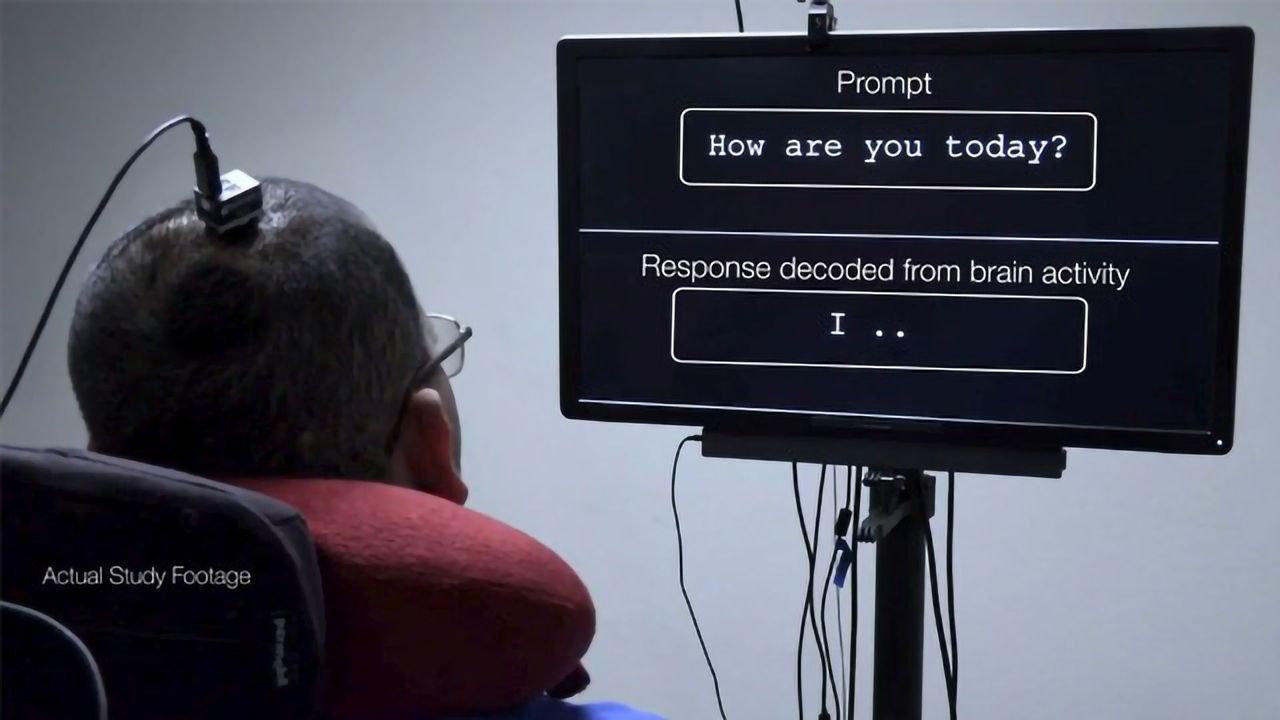 Implant Directly Translates Paralyzed Man's Brain Signals Into Speech