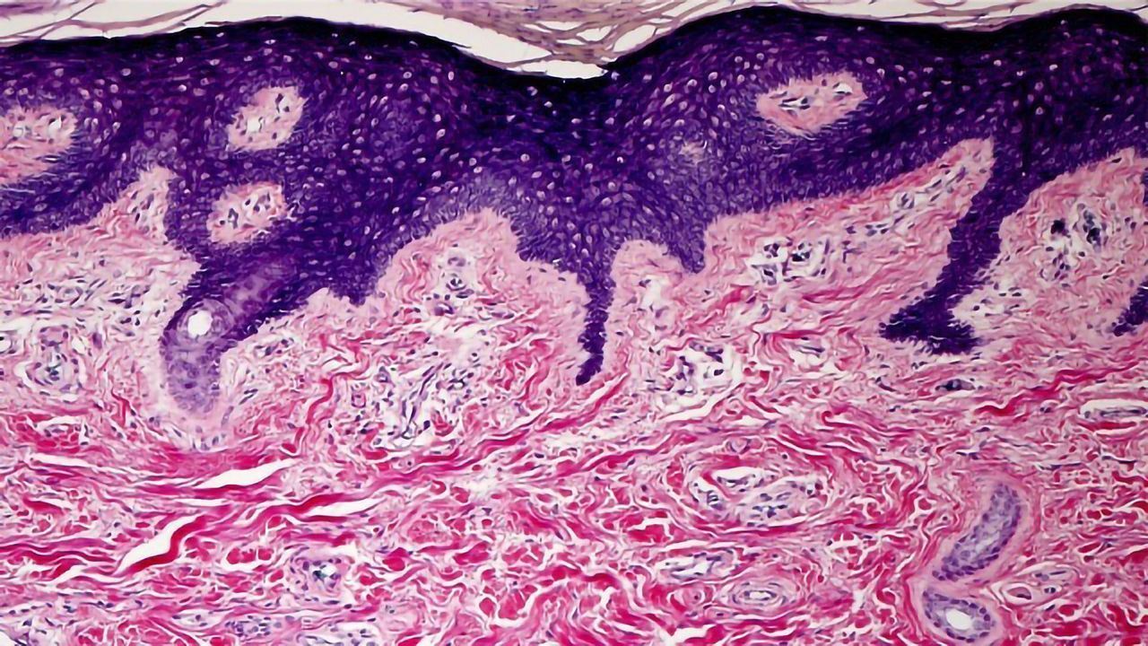 Normal & Disease-State FFPE Tissue Blocks