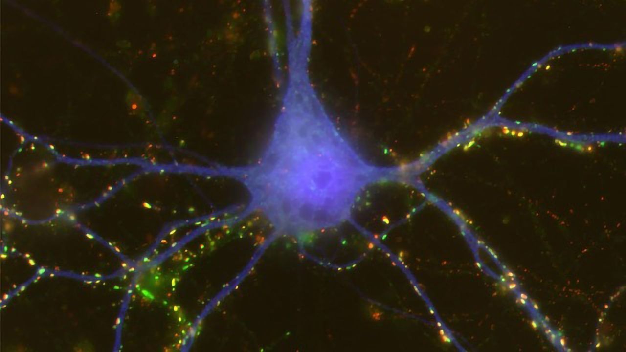 Sex Differences May Influence How Brain Cells Connect
