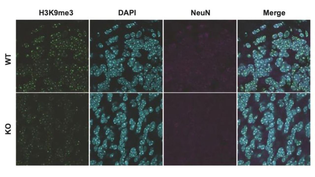 Role of Novel Genetic Variant in Autism Spectrum Disorders Uncovered