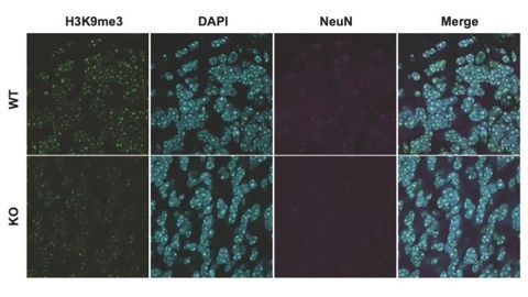 Role of Novel Genetic Variant in Autism Spectrum Disorders Uncovered