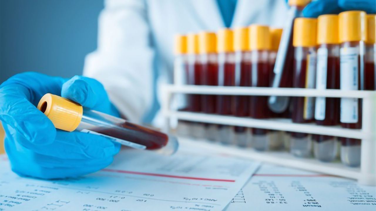 Fundamentals of Therapeutic Drug Monitoring: Definition, Importance and Methods