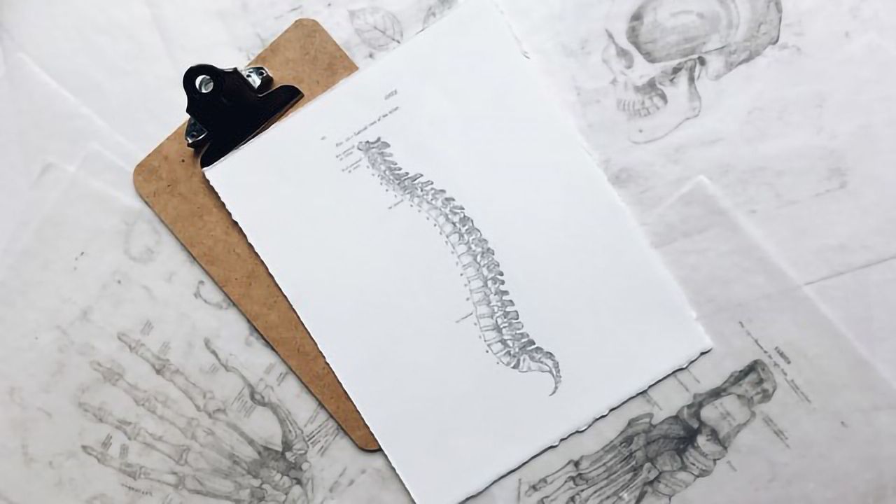 Spinal Fluid Biomarkers Detect Neurodegeneration
