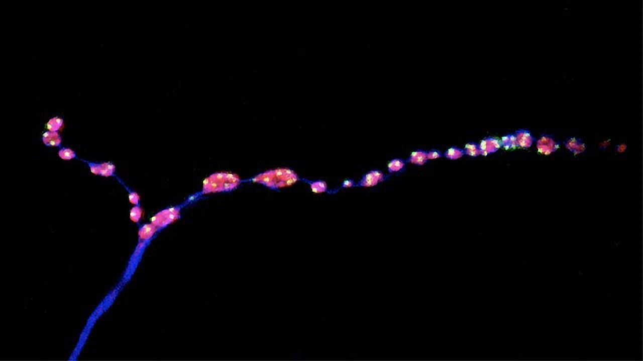 "Background Noise" in the Brain Keeps Nerve Connections Young