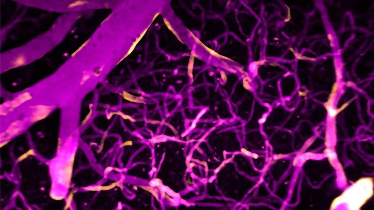Calcium Shown To Direct Blood Flow in the Brain