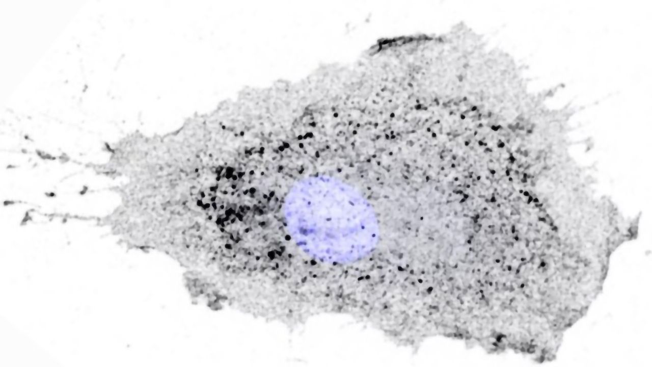 Cancer Metastasis: “Courier” Protein Inside Cells Provides Clues