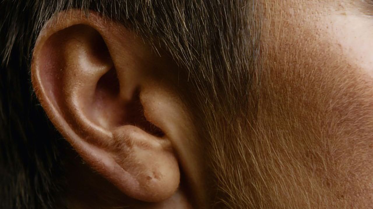 Trouble Hearing Speech May Be Associated With Increased Risk of Dementia