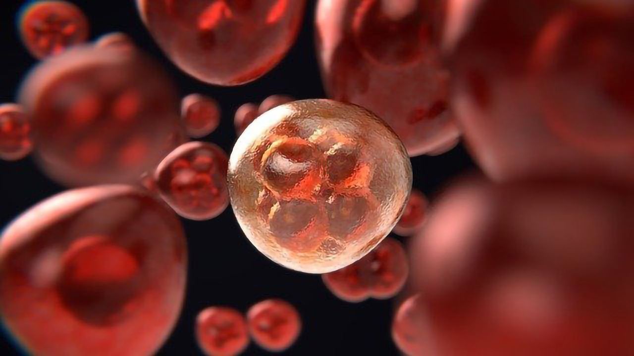 Assessing Replication-Stress Sensitivity in Breast Cancer Cells