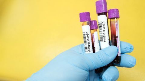 Biomarker Could Help Diagnose Schizophrenia at an Early Age