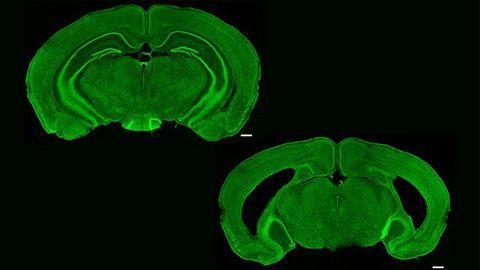 The Brain's Memory Center Is Needed To Recognize Image Sequences