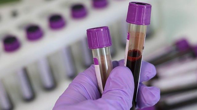 DNA标签可以帮助评估癌症治疗效果内容块的形象