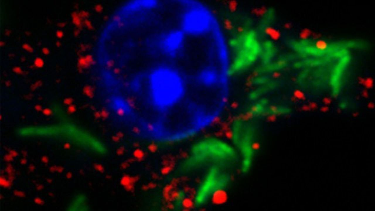 Tuberculosis Suppresses Immunity in a Surprising Way