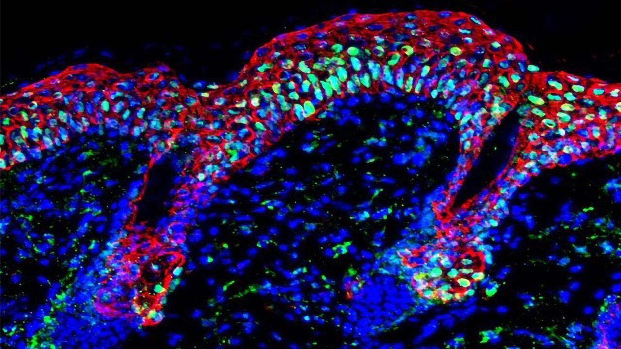 Cells Revisit Memories of Past Inflammation To React to New Threats