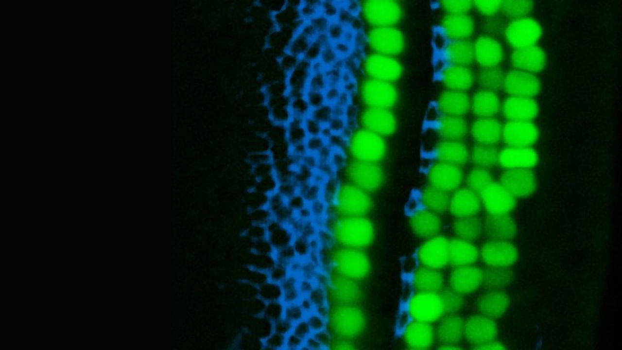 Latent Regenerative Potential of the Inner Ear Explored