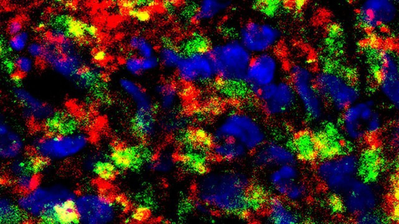 Mini Brain Models Used To Study Alzheimer’s and Test Drugs