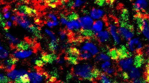 Mini Brain Models Used To Study Alzheimer’s and Test Drugs