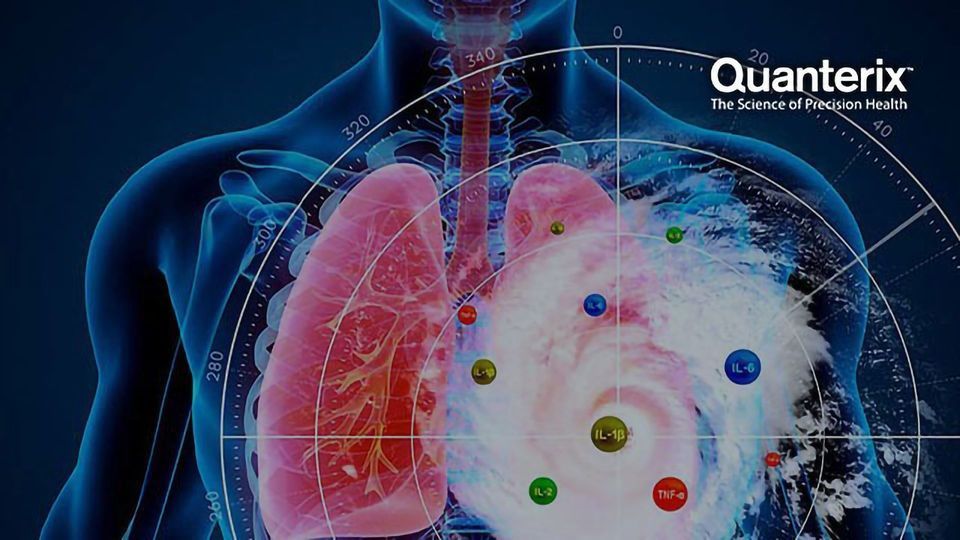 Cytokine Profiles and Personalized Therapeutics in COVID-19 Patients content piece image