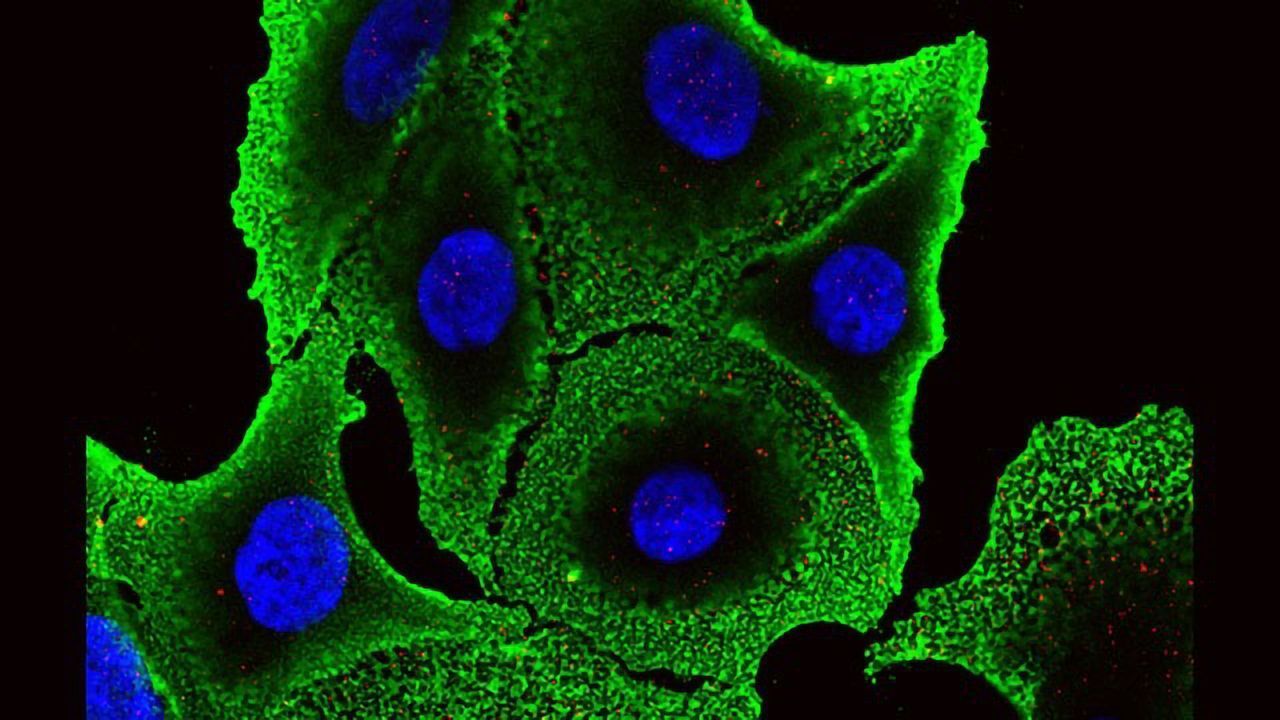 A New Opportunity To Kill Aggressive Cancer Cells?