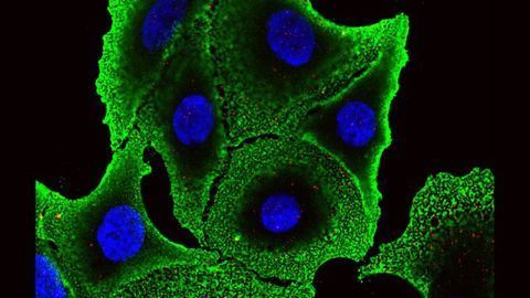 A New Opportunity To Kill Aggressive Cancer Cells?