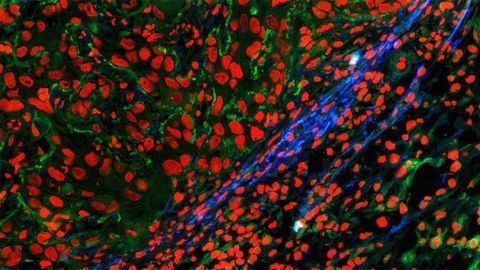 Illuminating the Growth of New Tissues