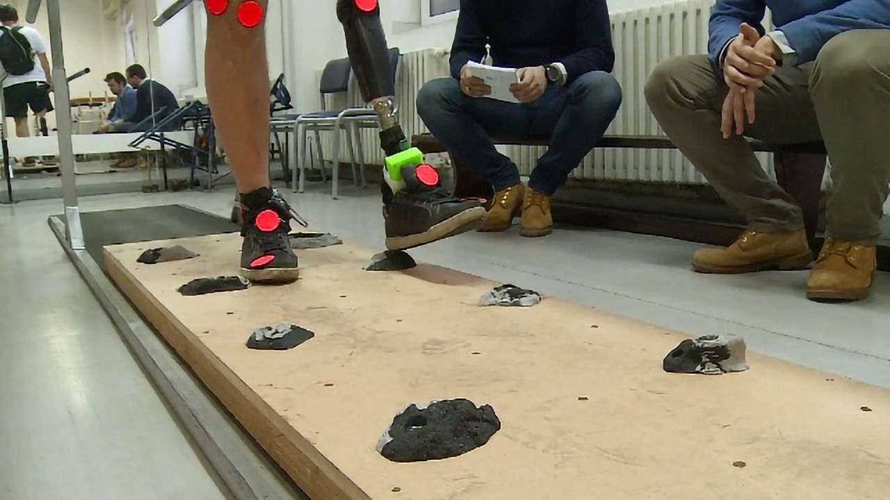 Best Foot Forward: Advanced Artificial Limb Research Wins Neuromodulation Prize