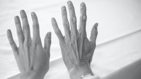 Two New Drugs Could Prevent Skin Aging Caused by Sun