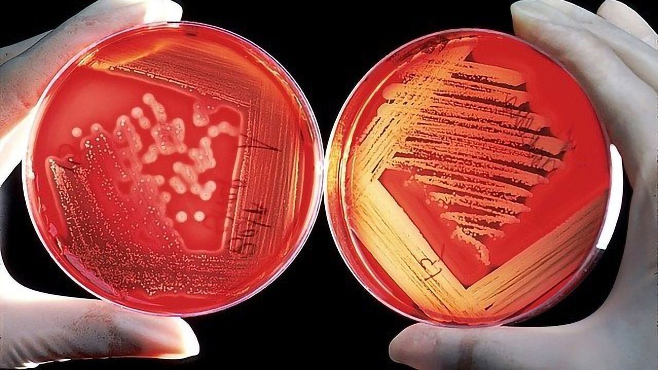 Seeking To Define Social Order in Bacterial Communities