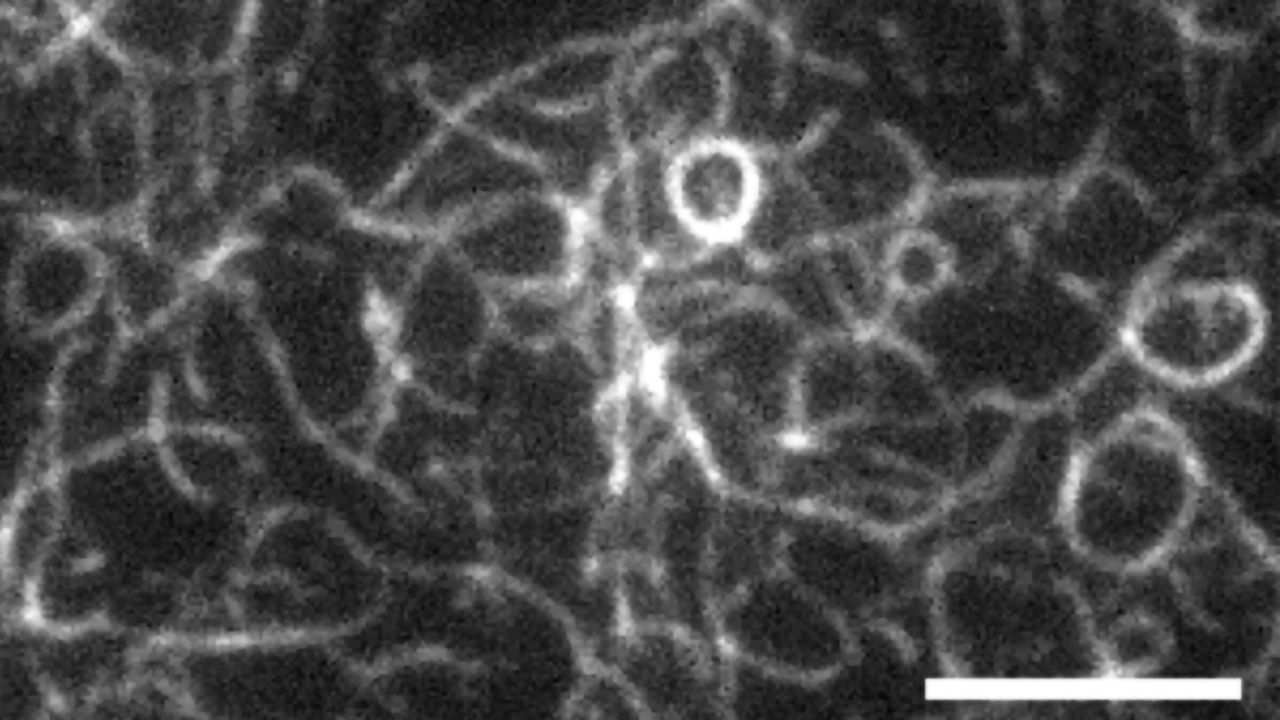Tiny Protein "Squeezes" Cells Like Balloon Animals