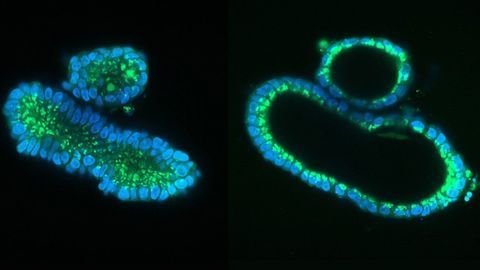 New CRISPR Technique Corrects Cystic Fibrosis in Human Stem Cells
