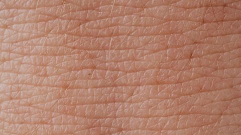 Enzyme Treatment Helps To Identify Bacteria Living on the Skin