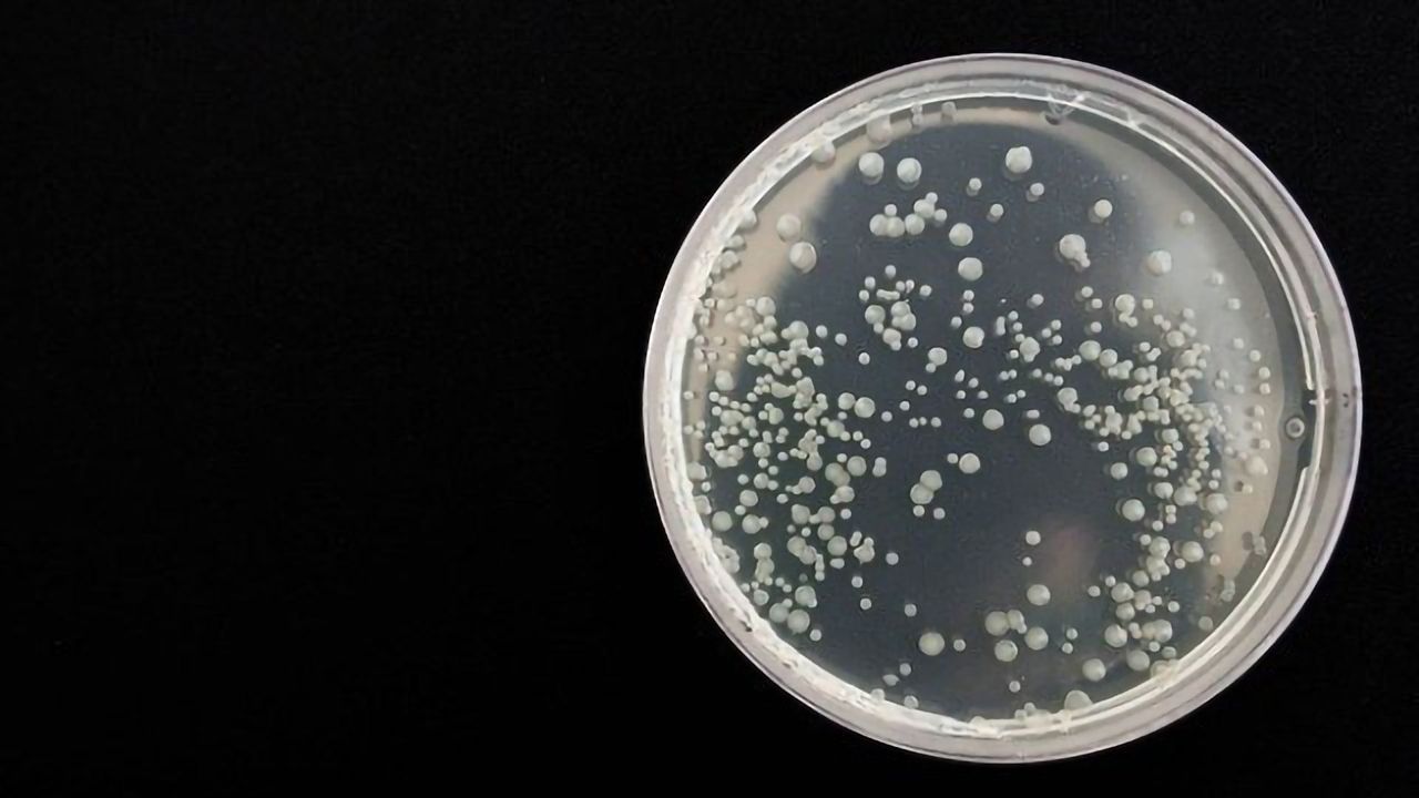 National Atlas for Deadly Food Pathogen Listeria Created
