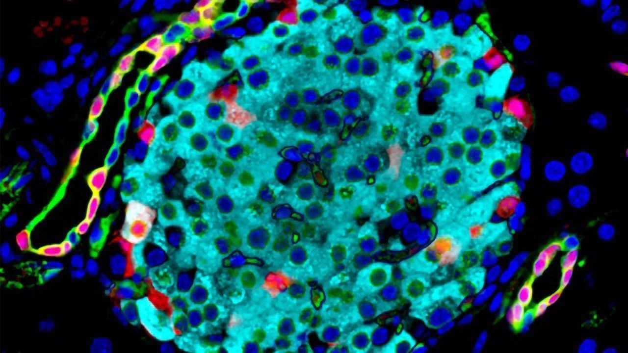 Gene That Boosts Insulin-Producing Cells Points to Potential Diabetes Treatment