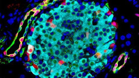 Gene That Boosts Insulin-Producing Cells Points to Potential Diabetes Treatment