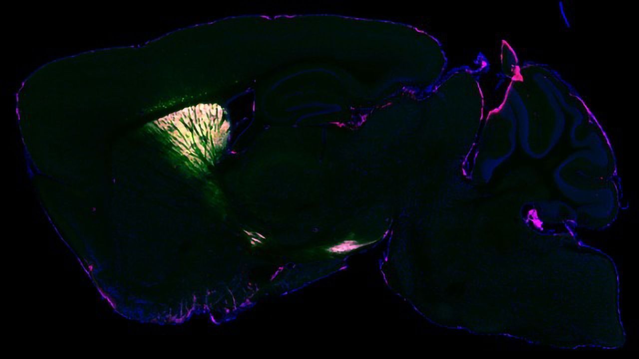 Virus-Delivered Enzyme Allows Researchers To View Proteins in the Living Brain