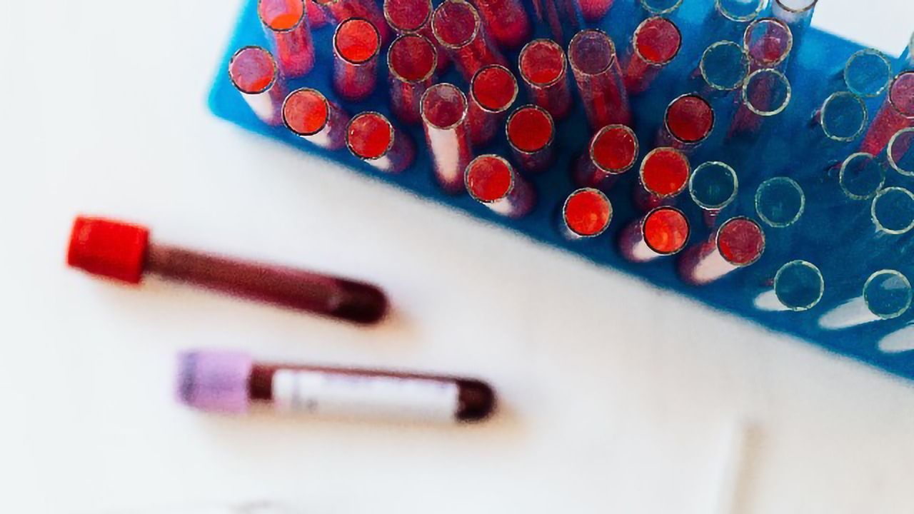 CRISPR-Based Technology Could Revolutionize Antibody-Based Medical Diagnostics
