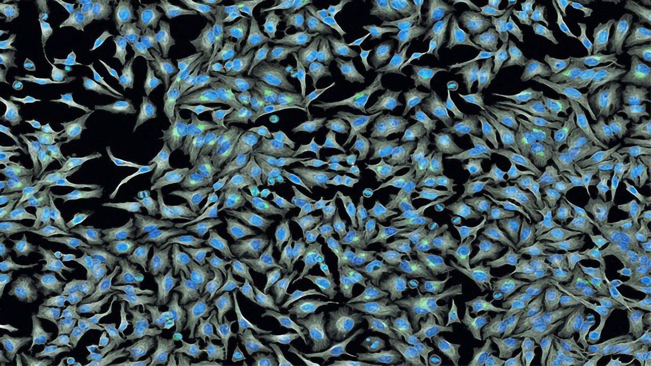 Tagging Tumor Cells To Track How They Evolve